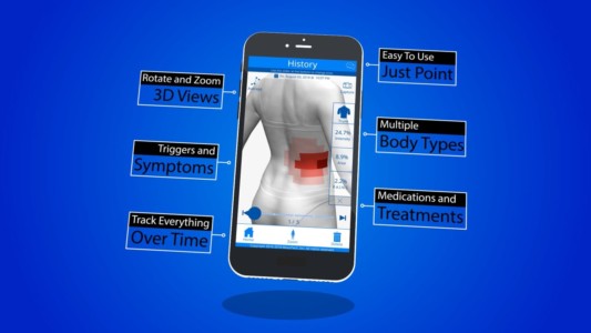 Clinically validated chronic pain tool used by patients, clinicians, and pharma. GeoPain - Chronic Pain Tracker